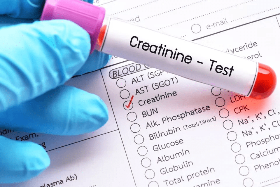 how will the creatinine level tell your kidney health?